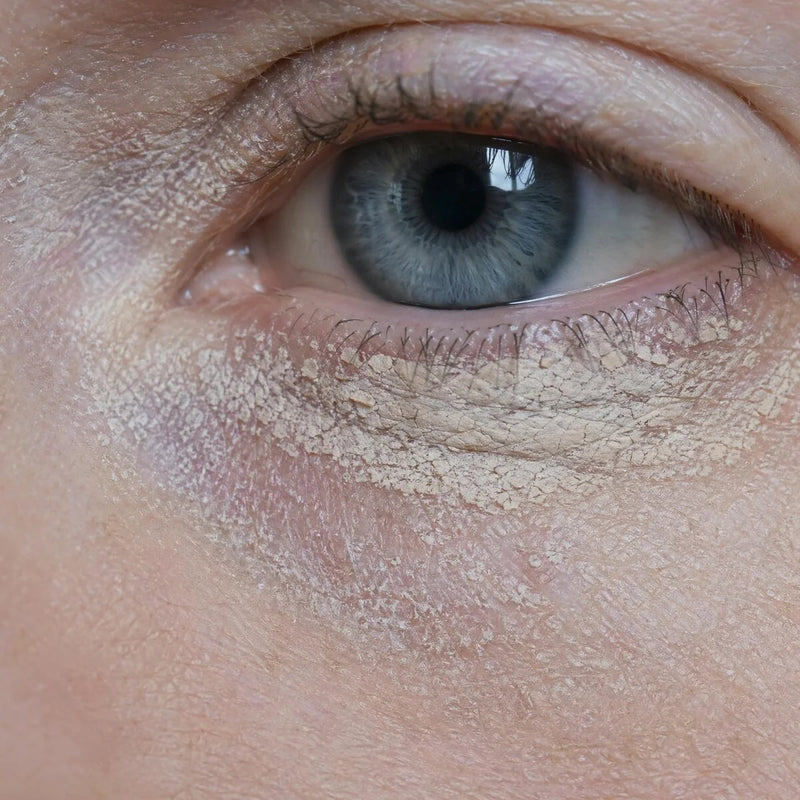 Ihr Concealer ist nicht zu schwach. Ihre Hautoberfläche ist zu unruhig.