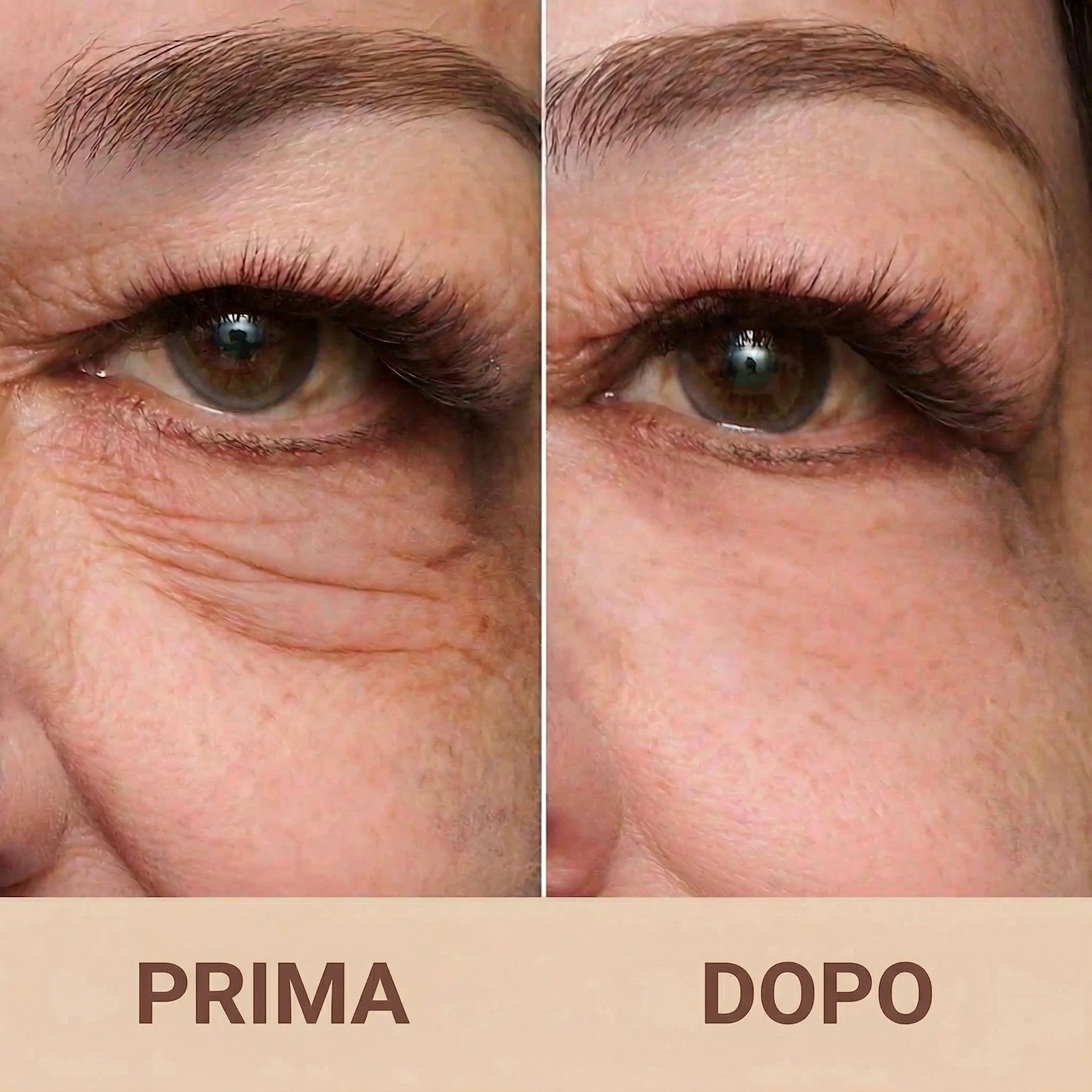 Prima / Dopo