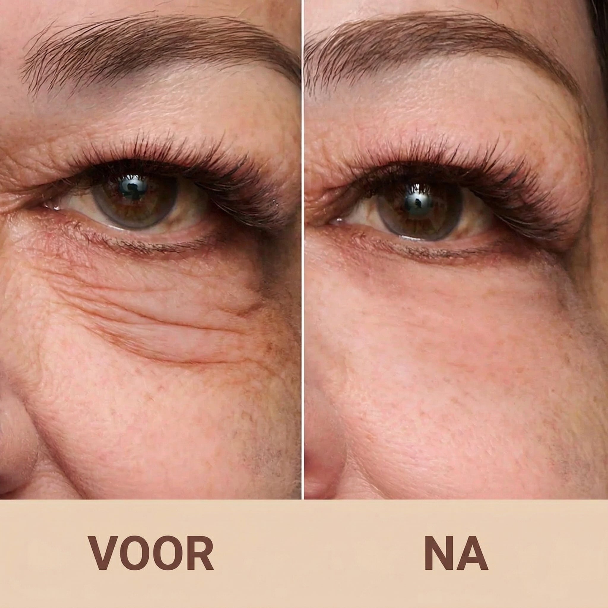 Voor / Na