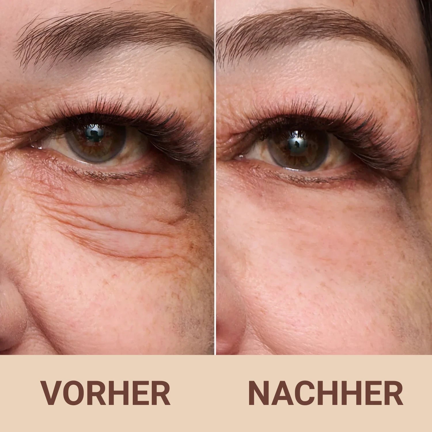 Vita-A Retinal Shot™ Straffungs-Booster